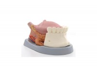kompleksowy model żuchwy (lewa połowa) z chorymi zębami, nerwami, naczyniami i gruczołami, 19 części - 1001250 [ve290] 3b scientific modele anatomiczne 13